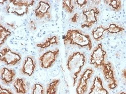 Carbonic Anhydrase IX/CA9 Antibody (CA9/2993R) - Azide and BSA Free, Novus